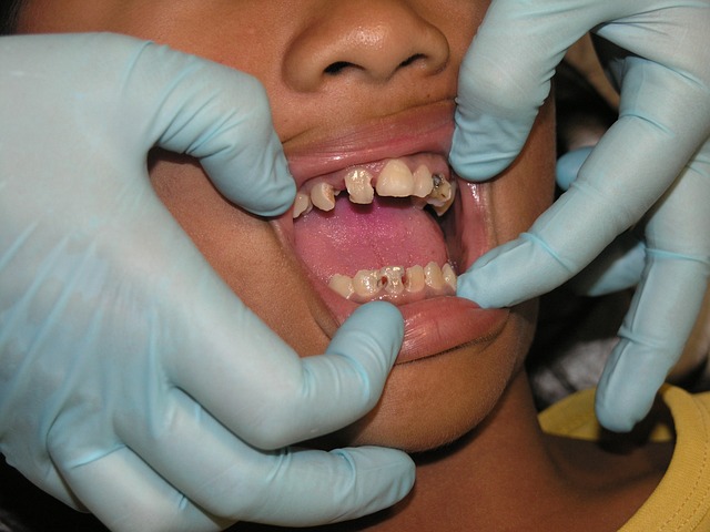 1. Příčiny zubní‌ bolesti: Odhalení ⁣hlavního ​zdroje vašich problémů se zuby