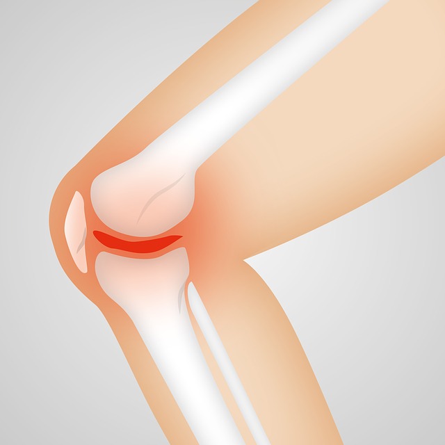 3. Babské⁣ rady pro úlevu od bolesti a ztuhlosti při ⁢artróze kolene