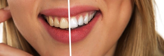 2. Osobní‍ hygiena a péče o ústní dutinu jako prevence výskytu ústních vředů