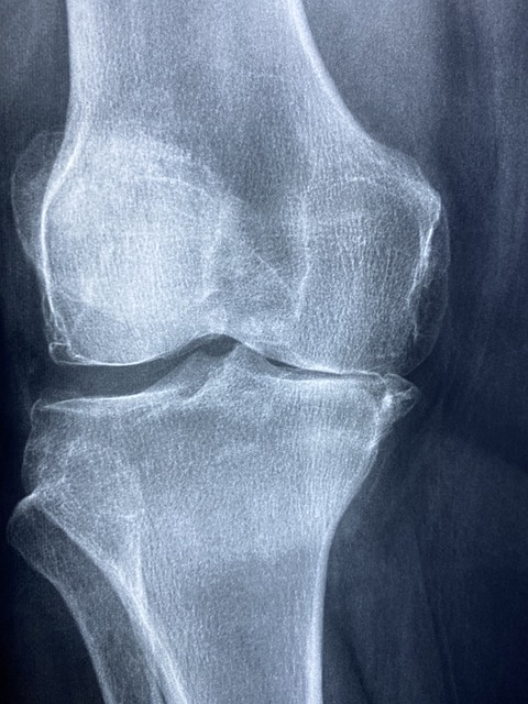 Diagnóza zánětu kolene: Jak určit přesnou příčinu bolesti