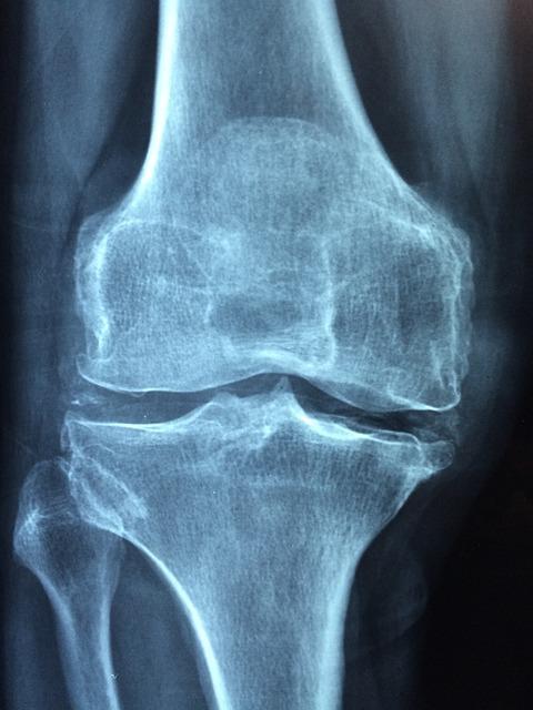 1. Přehled nejběžnějších příčin bolesti kolena a jejich zvládání