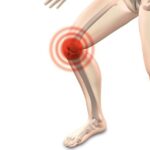 Artroza kolene: Babské rady pro snížení bolesti