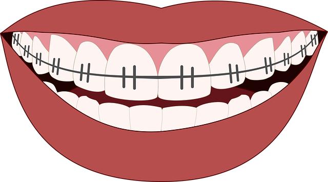 8. Jak péče o ústa může‍ zabránit vzniku oparu:⁢ Preventivní opatření pro minimalizaci opakování